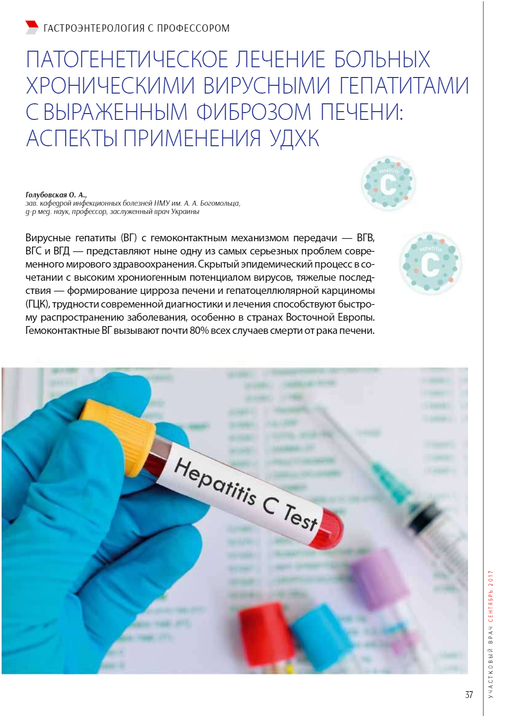 Патогенетичне лікування хворих на хронічні вірусні гепатити з вираженим фіброзом печінки: аспекти застосування УДХК
