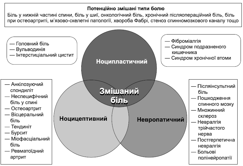 Сучасні концепції виникнення болю та можливості його подолання в загальній лікарській практиці